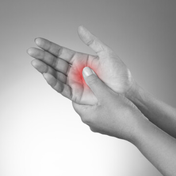 A lady with carpal tunnel after getting several bowling-related injuries over the year from using heavy bowling balls.