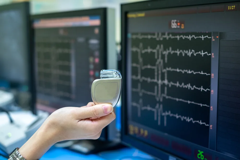 Doctor discussing pacemaker insertion compared to implantable defibrillators with a potential patient.