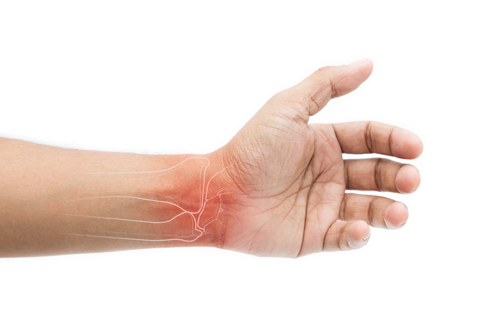 A typical hand of professional bowlers showing the most common bowling injuries are on the wrist and shoulder injuries.