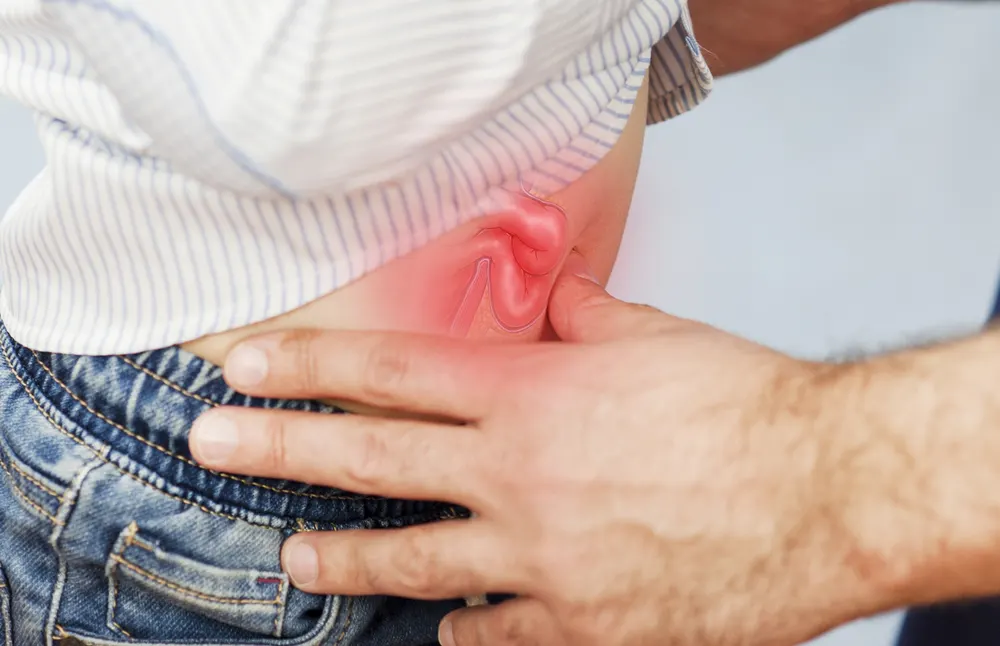 Can You Bowl With A Hernia? What Activities Should Be Avoided With A Hernia? 1 The doctor examines the bowler, looks at the navel and hernia, checks the stomach on an isolated blue background due to severe abdominal pain